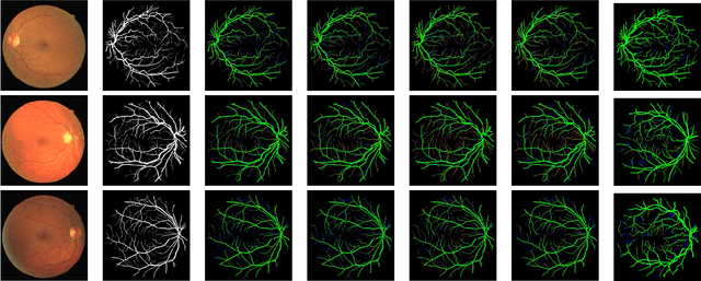 Figure 3 for LVS-Net: A Lightweight Vessels Segmentation Network for Retinal Image Analysis