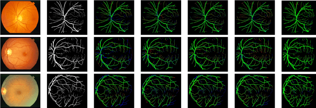 Figure 4 for LVS-Net: A Lightweight Vessels Segmentation Network for Retinal Image Analysis