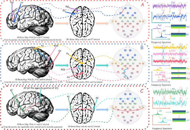 Figure 2 for You Only Acquire Sparse-channel (YOAS): A Unified Framework for Dense-channel EEG Generation