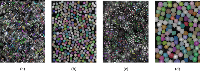 Figure 3 for Automated Segmentation and Analysis of Cone Photoreceptors in Multimodal Adaptive Optics Imaging