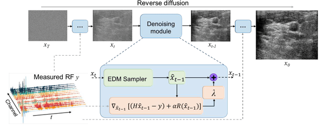 Figure 1 for Fast Sampling generative model for Ultrasound image reconstruction