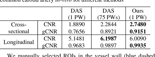 Figure 4 for Fast Sampling generative model for Ultrasound image reconstruction