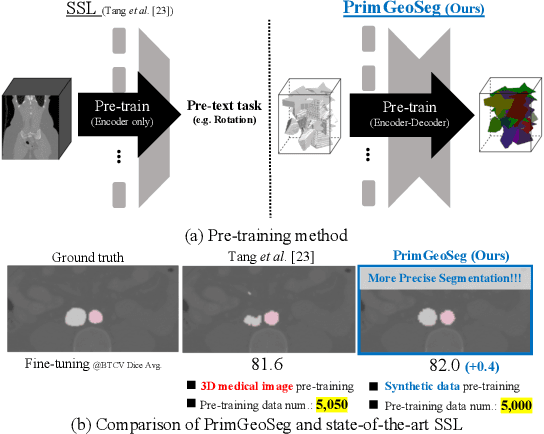 Figure 1 for Primitive Geometry Segment Pre-training for 3D Medical Image Segmentation