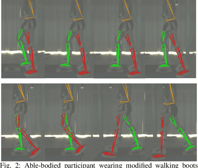 Figure 2 for An Experimental Setup to Test Obstacle-dealing Capabilities of Prosthetic Feet