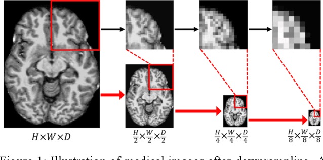 Figure 1 for Full-resolution MLPs Empower Medical Dense Prediction