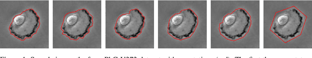 Figure 1 for That Label's Got Style: Handling Label Style Bias for Uncertain Image Segmentation