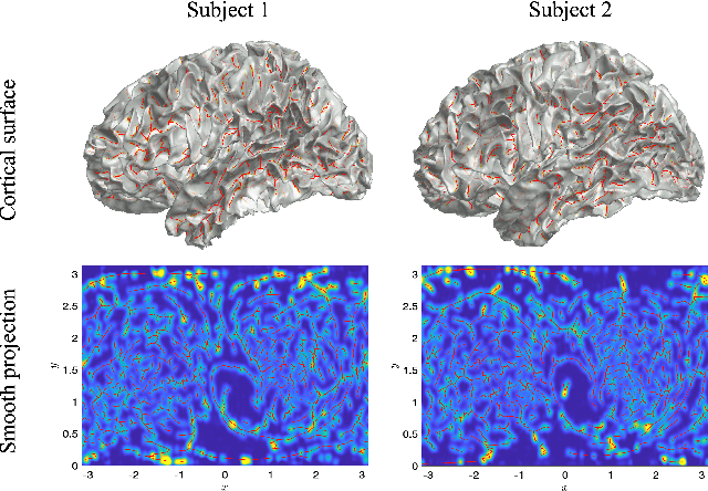 Figure 1 for Sulcal Pattern Matching with the Wasserstein Distance