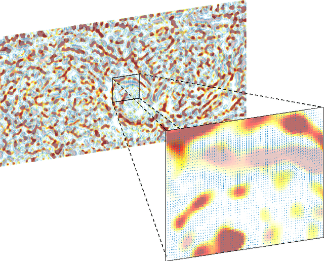 Figure 2 for Sulcal Pattern Matching with the Wasserstein Distance