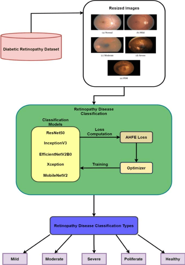 Figure 1 for A Novel Adaptive Hybrid Focal-Entropy Loss for Enhancing Diabetic Retinopathy Detection Using Convolutional Neural Networks