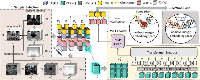 Figure 3 for Multi-view Contrastive Learning with Additive Margin for Adaptive Nasopharyngeal Carcinoma Radiotherapy Prediction