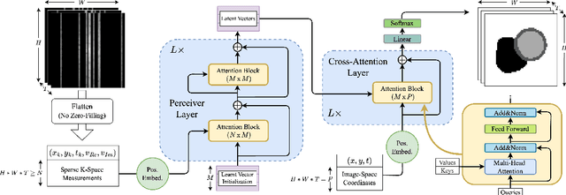 Figure 1 for Direct Cardiac Segmentation from Undersampled K-space Using Transformers