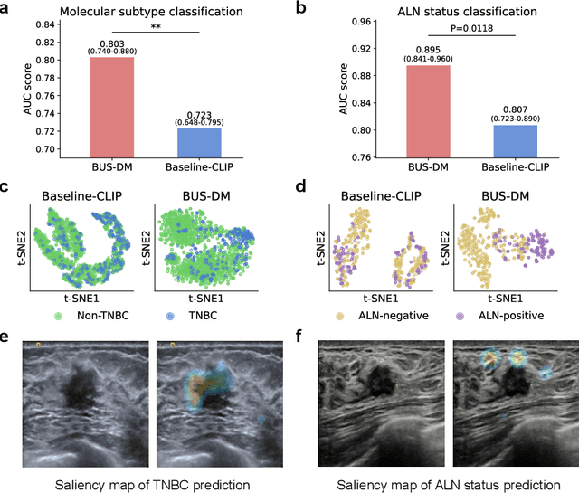 Figure 4 for A Foundational Generative Model for Breast Ultrasound Image Analysis