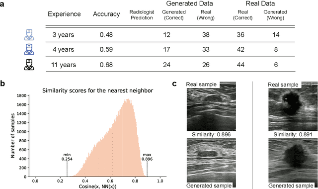 Figure 2 for A Foundational Generative Model for Breast Ultrasound Image Analysis