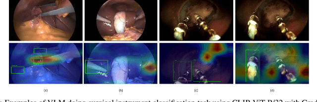Figure 1 for Benchmarking performance, explainability, and evaluation strategies of vision-language models for surgery: Challenges and opportunities