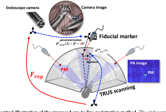 Figure 2 for Arc-to-line frame registration method for ultrasound and photoacoustic image-guided intraoperative robot-assisted laparoscopic prostatectomy