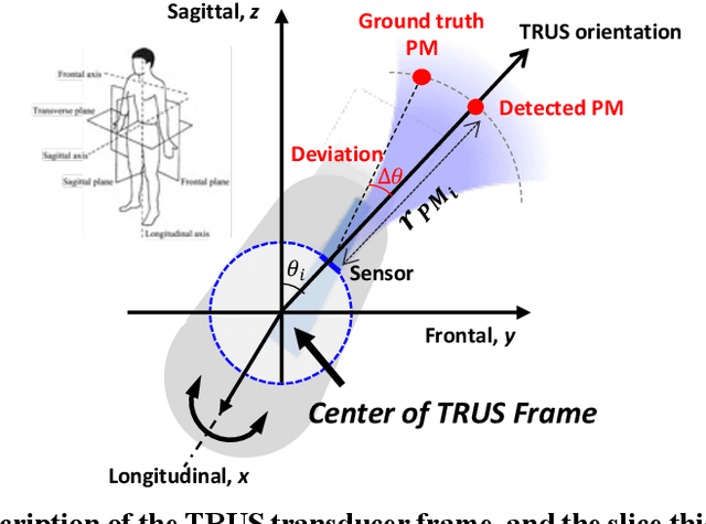 Figure 3 for Arc-to-line frame registration method for ultrasound and photoacoustic image-guided intraoperative robot-assisted laparoscopic prostatectomy