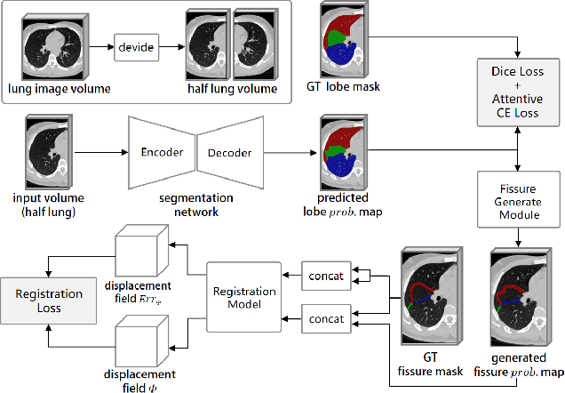 Figure 1 for Automatic lobe segmentation using attentive cross entropy and end-to-end fissure generation