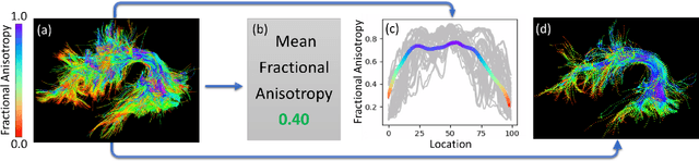 Figure 1 for TractGeoNet: A geometric deep learning framework for pointwise analysis of tract microstructure to predict language assessment performance