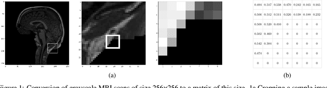 Figure 2 for U-net based prediction of cerebrospinal fluid distribution and ventricular reflux grading