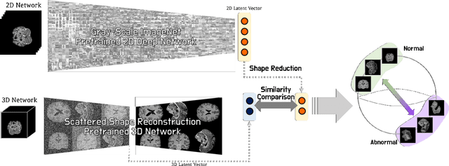 Figure 2 for Joint Embedding of 2D and 3D Networks for Medical Image Anomaly Detection