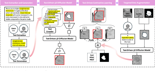 Figure 3 for Text-Driven Tumor Synthesis