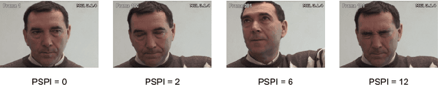 Figure 1 for Fully-attentive and interpretable: vision and video vision transformers for pain detection