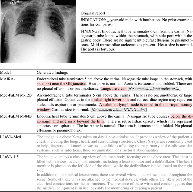 Figure 1 for MAIRA-1: A specialised large multimodal model for radiology report generation