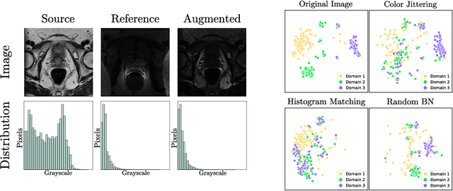 Figure 3 for The Devil is in the Statistics: Mitigating and Exploiting Statistics Difference for Generalizable Semi-supervised Medical Image Segmentation