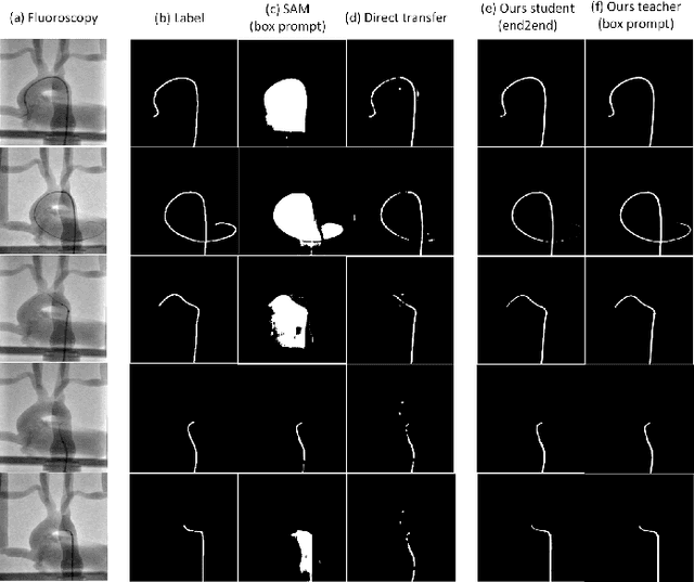 Figure 3 for Generalizing Segmentation Foundation Model Under Sim-to-real Domain-shift for Guidewire Segmentation in X-ray Fluoroscopy