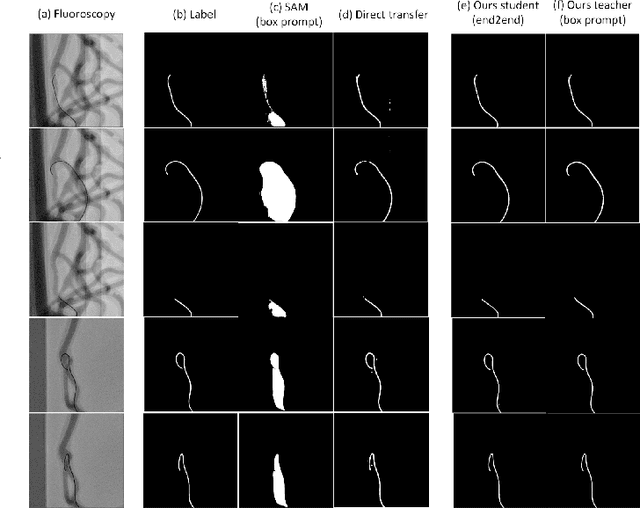 Figure 4 for Generalizing Segmentation Foundation Model Under Sim-to-real Domain-shift for Guidewire Segmentation in X-ray Fluoroscopy