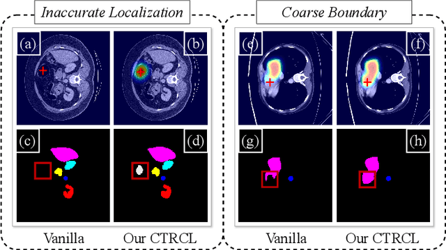 Figure 1 for CNN-Transformer Rectified Collaborative Learning for Medical Image Segmentation