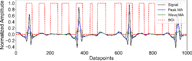 Figure 4 for Resource-Efficient Heartbeat Classification Using Multi-Feature Fusion and Bidirectional LSTM