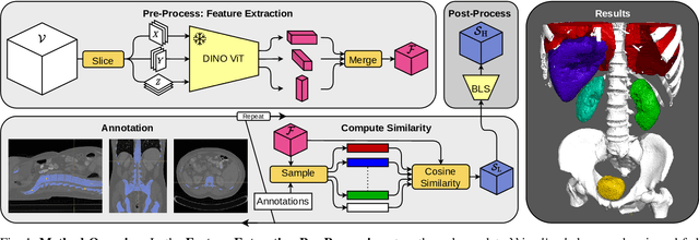 Figure 1 for Leveraging Self-Supervised Vision Transformers for Neural Transfer Function Design