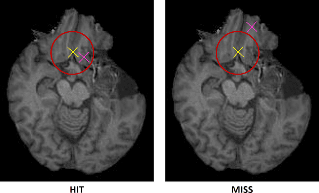 Figure 1 for Framing image registration as a landmark detection problem for better representation of clinical relevance