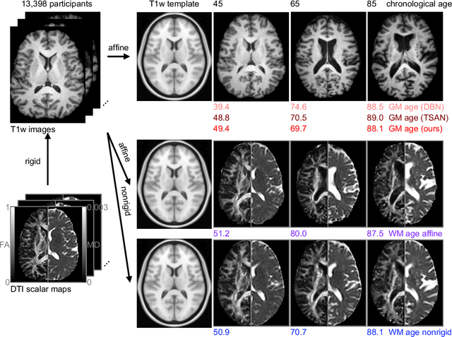 Figure 1 for Brain age identification from diffusion MRI synergistically predicts neurodegenerative disease