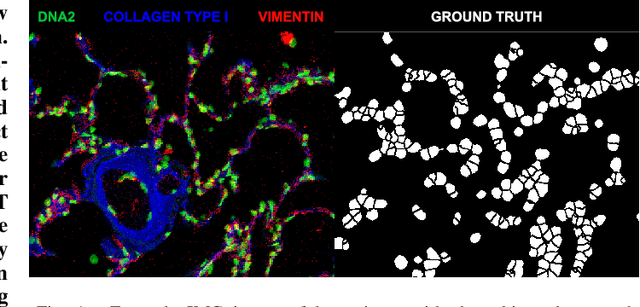 Figure 1 for Pushing the limits of cell segmentation models for imaging mass cytometry