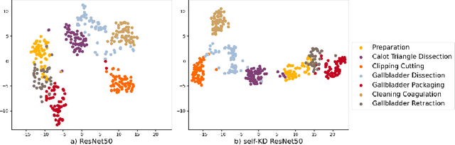 Figure 3 for Self-Knowledge Distillation for Surgical Phase Recognition