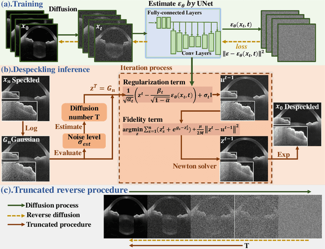 Figure 3 for Content-Preserving Diffusion Model for Unsupervised AS-OCT image Despeckling