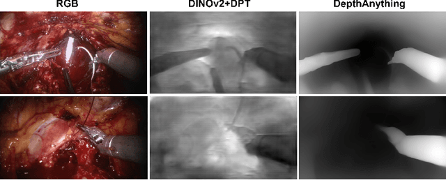 Figure 1 for Rethinking RGB-D Fusion for Semantic Segmentation in Surgical Datasets