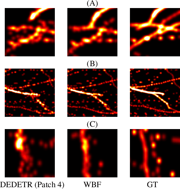 Figure 3 for Ensemble Learning for Microbubble Localization in Super-Resolution Ultrasound