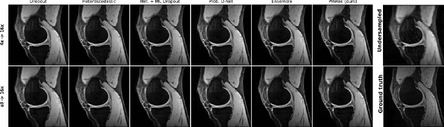 Figure 4 for Uncertainty Estimation and Propagation in Accelerated MRI Reconstruction