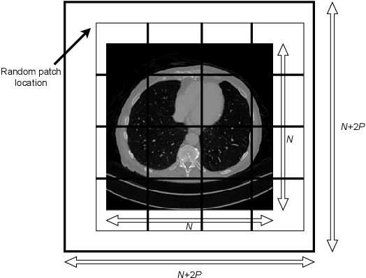 Figure 1 for Patch-Based Diffusion Models Beat Whole-Image Models for Mismatched Distribution Inverse Problems