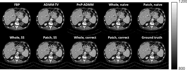 Figure 3 for Patch-Based Diffusion Models Beat Whole-Image Models for Mismatched Distribution Inverse Problems