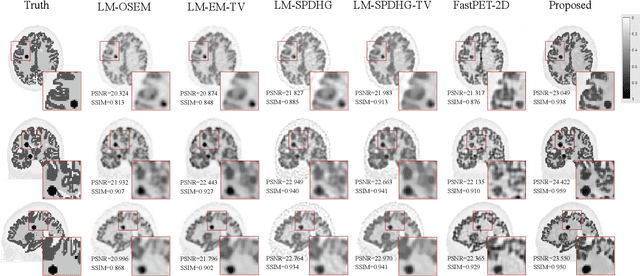 Figure 4 for Deep unrolled primal dual network for TOF-PET list-mode image reconstruction