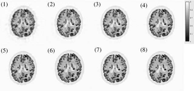 Figure 2 for Deep unrolled primal dual network for TOF-PET list-mode image reconstruction