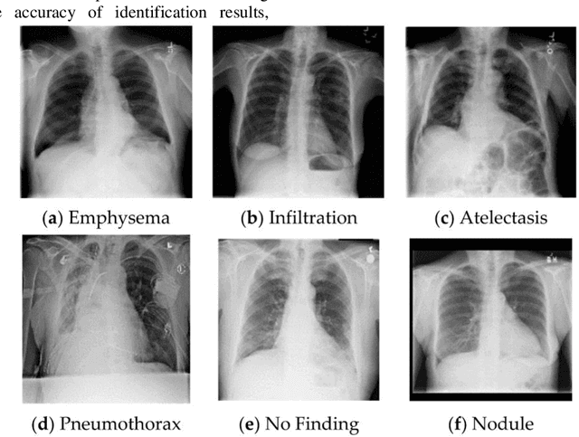 Figure 3 for Research on Deep Learning Model of Feature Extraction Based on Convolutional Neural Network