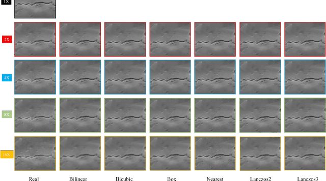 Figure 3 for Enhancing digital core image resolution using optimal upscaling algorithm: with application to paired SEM images