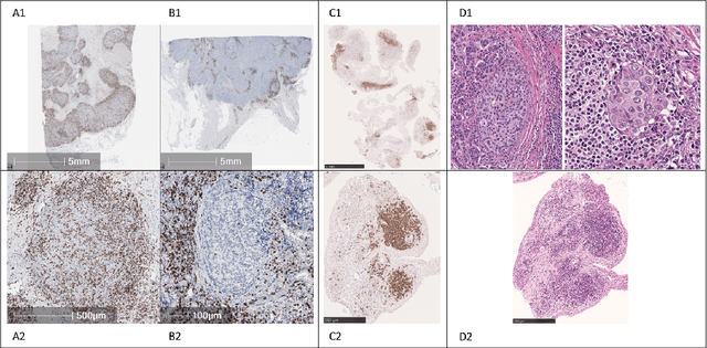 Figure 1 for Going Beyond H&E and Oncology: How Do Histopathology Foundation Models Perform for Multi-stain IHC and Immunology?