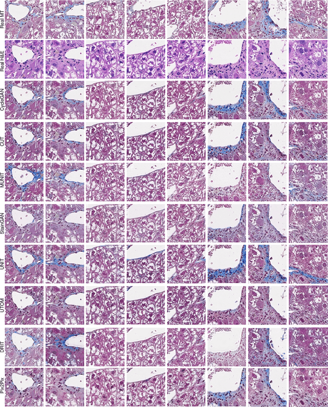 Figure 3 for A comparative evaluation of image-to-image translation methods for stain transfer in histopathology