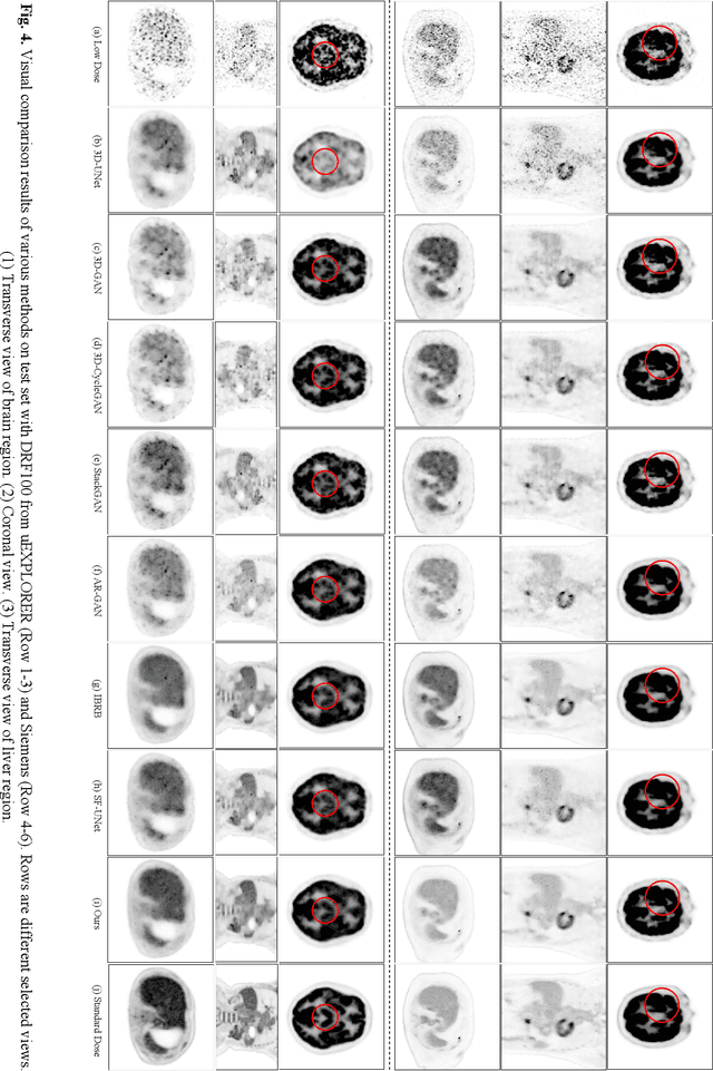 Figure 4 for PET Synthesis via Self-supervised Adaptive Residual Estimation Generative Adversarial Network